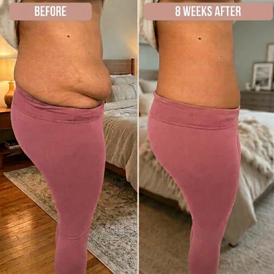 Calvosi™ Postpartum Shaping Underwear